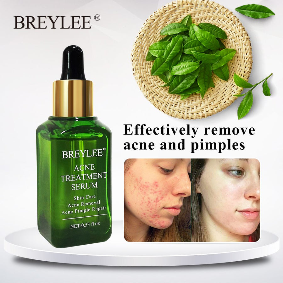 Breylee acne treatment serum with green leaves and before-and-after images on a white background